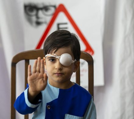 طرح پیشگیری از تنبلی چشم برای ۱۹ هزار و ۶۶۸ کودک قزوینی اجرا شد